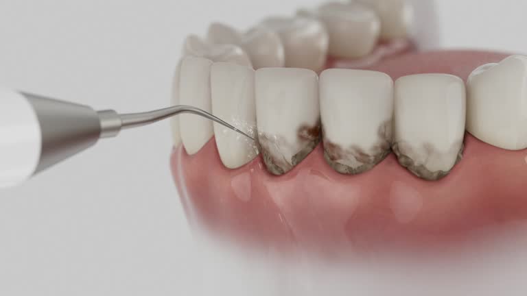 Trusted Teeth Cleaning And Checkup service in Tuolumne City, CA - Dentist Open Now
